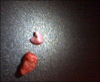 post-730-1178644313_thumb.jpg