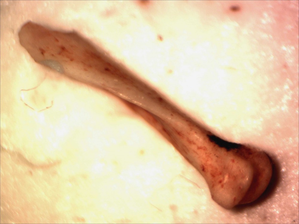 002humerus-bl.jpg