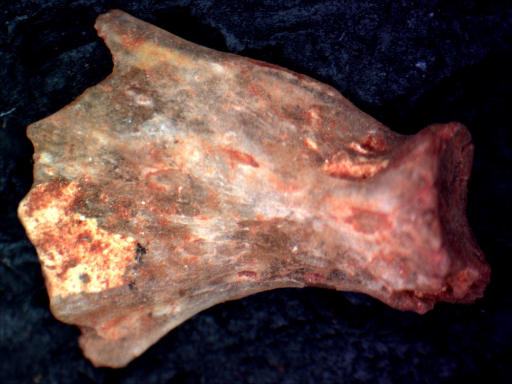 22case1b.jpg
