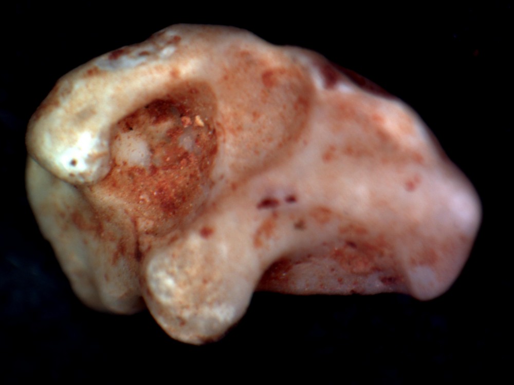 23case2.jpg