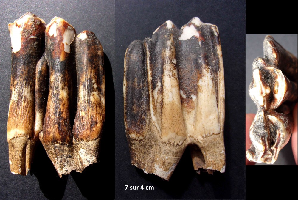 denta1.jpg