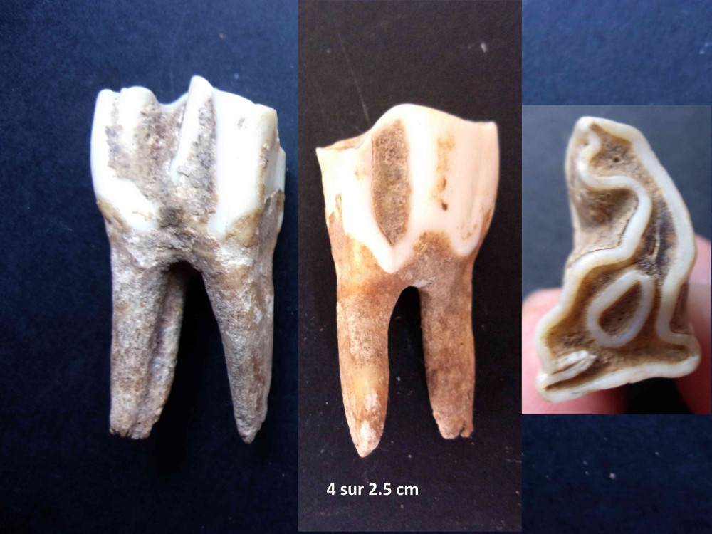 denta6.JPG