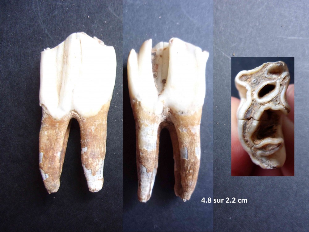 denta7.JPG