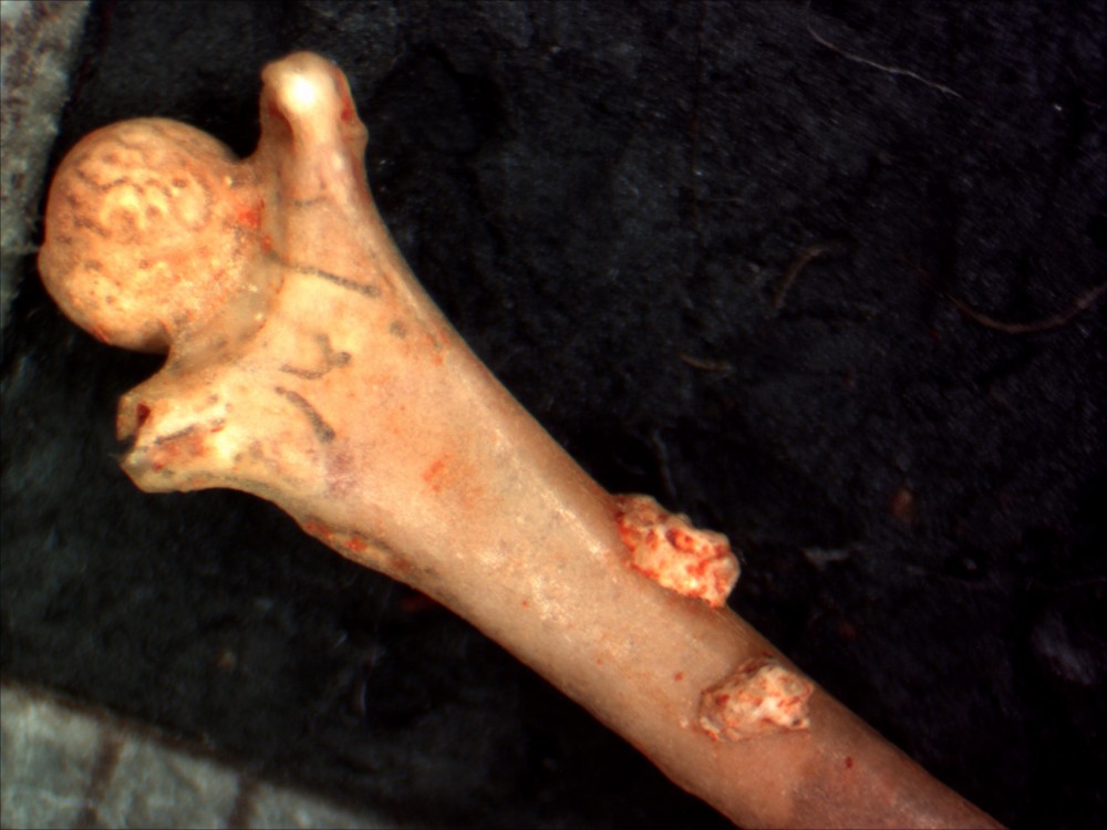 Femur002a.jpg