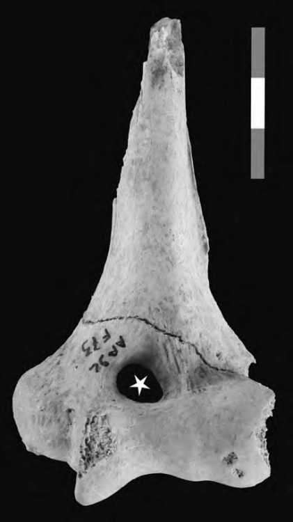 Perforation-de-la-fossette-olecranienne-dun-humerus-gauche-de-la-sepulture.png