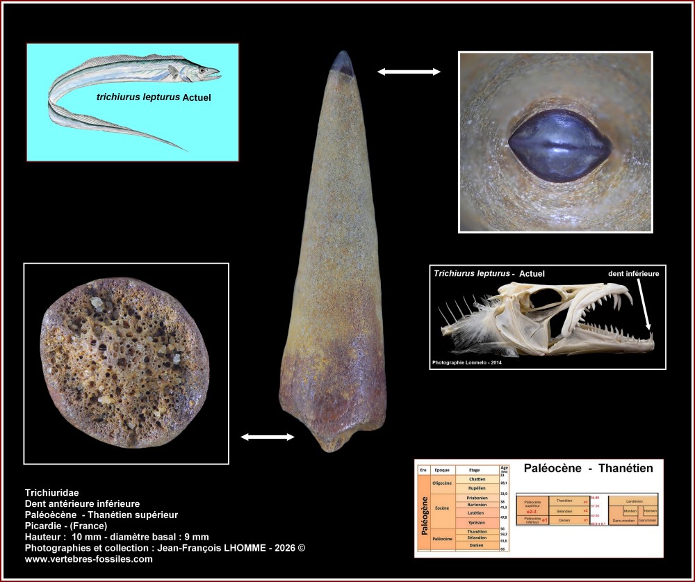 pl_dent_poisson_trichuiridae.jpg